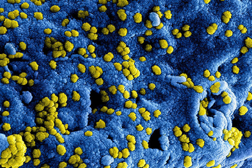 Coronavirus van onder een microscoop